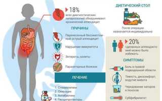 Аппендицит. Симптомы у взрослых мужчин. Стадии, осложнения, диагностика, УЗИ, лечение, диета, операция