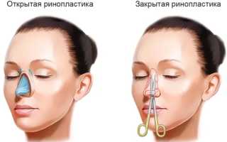 Положение Тренделенбурга. Что это такое, как применяется при операциях, рентгене, анафилактическом шоке