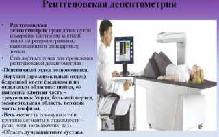 Денситометрия. Что это такое, УЗИ костей, рентгеновская, КТ. Как подготовится, проводится исследование, цена. Расшифровка результатов