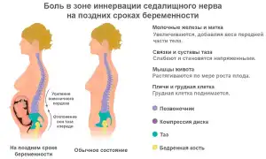 Болит спина при беременности на ранних сроках. Признаки, что делать