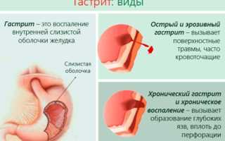Санаторно-курортное лечение. Что это такое, кому положено бесплатно за счёт работодателя для инвалидов, военных пенсионеров, ветеранов труда
