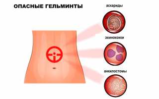 Симптомы глистов у взрослого человека в кишечнике, признаки. Диагностика, лечение народными средствами, препараты