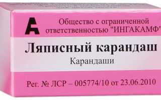 Ляписный карандаш от папиллом. Инструкция по применению, цена, отзывы