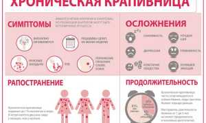 Демографическая крапивница. Чем лечить, таблетки, диета, причины появления, симптомы, какими вызывается механизмами, патогенез