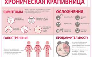 Демографическая крапивница. Чем лечить, таблетки, диета, причины появления, симптомы, какими вызывается механизмами, патогенез