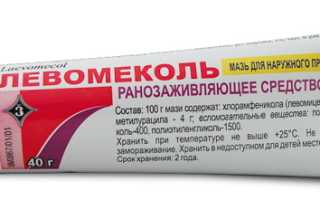 Мазь от опрелостей для новорожденных. Рейтинг лучших