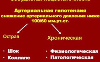 Острая сосудистая недостаточность (ОСдН). Что это такое, чем характеризуется, как проявляется