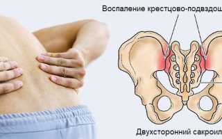 Продуло спину в районе поясницы. Как лечить