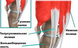 Гусиная лапка коленного сустава. Что это такое, анатомия, лечение