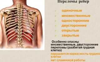 Перелом ребра. Симптомы, первая помощь, бандаж, лечение в домашних условиях, сколько заживает, осложнения