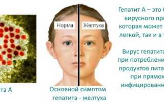 Болезни, передающиеся через поцелуй, слюну. Список