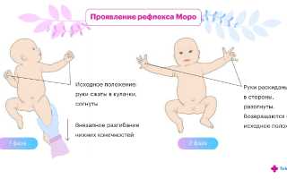 Рефлекс Моро у новорожденных, взрослых. Что это такое, как избавиться