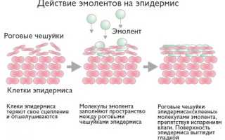 Эмоленты при атопическом дерматите у взрослых. Список