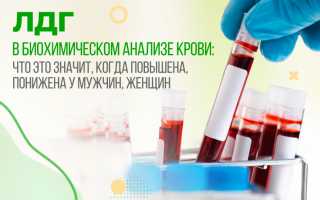 Ldh в биохимическом анализе крови. Что это такое, норма, повышен, понижен у мужчин, женщин