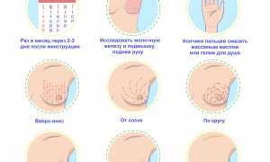 Опухоль молочной железы у женщин. Симптомы, признаки, лечение