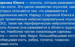 Саркома Юинга. Что это такое, симптомы, клинические рекомендации