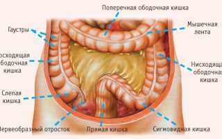 Спайки кишечника. Симптомы и лечение, народные средства, препараты, диета, упражнения