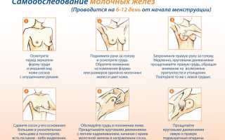 Массаж при фиброзной мастопатии молочных желез