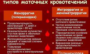 Меноррагия у женщин. Что это такое, симптомы, лечение