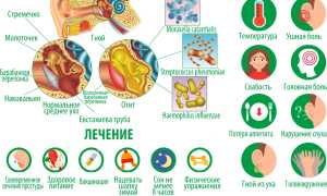 Гнойный отит у ребенка. Симптомы, лечение, капли