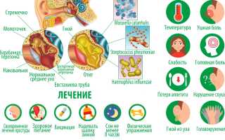Гнойный отит у ребенка. Симптомы, лечение, капли