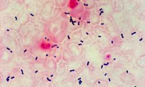 Enterococcus Faecalis (фекальный энтерококк) в мазке у женщин