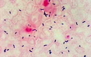 Enterococcus Faecalis (фекальный энтерококк) в мазке у женщин