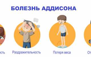Болезнь Аддисона (бронзовая). Что это такое, симптомы