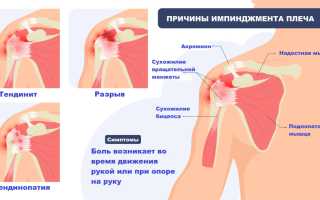 Причины боли в левом плече и предплечье. Резкая, ноющая, тупая боль и рекомендации врачей