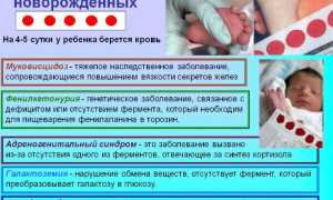 Генетический анализ крови ребенку, новорожденных. Что это, зачем, цена