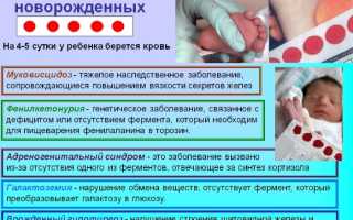 Генетический анализ крови ребенку, новорожденных. Что это, зачем, цена