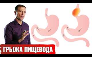 Грыжа пищевода. Лечение без операции народными средствами, диета