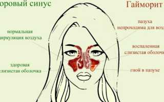 Мазь Симановского для носа. Инструкция по применению, отзывы