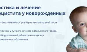 Дакриоцистит новорожденных. Фото, что это, массаж, лечение