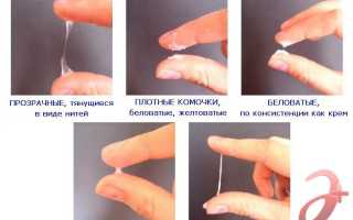 Выделения у женщин по дням цикла. Норма и отклонения, нормальные и ненормальные