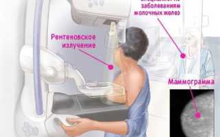 УЗИ молочных желез или маммография. Что лучше, точнее, эффективнее. Отличия, можно ли делать в один день