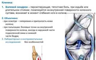 Периартрит коленного сустава. Симптомы и лечение сухожилий