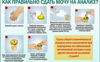 Как сдавать суточный анализ мочи, что он показывает