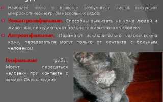 Разновидности лишая у человека. Фото, описание, симптомы и лечение