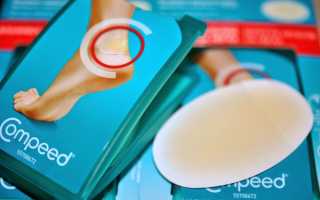 Компид (Compeed) пластырь от влажных мозолей, сухих, герпеса, натоптышей. Инструкция, виды, цена