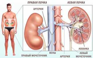 Нефроптоз (опущение почки). Что это такое, симптомы, лечение, как исправить