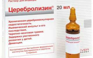 Церебролизин уколы. Инструкция, показания к применению, цена, отзывы