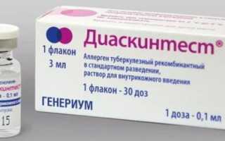 Синяк на месте Диаскинтеста после прививки это норма? Фото
