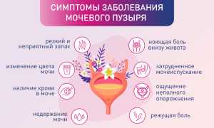 Боли в мочевом пузыре у женщин. Симптомы и лечение