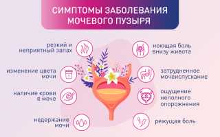 Боли в мочевом пузыре у женщин. Симптомы и лечение