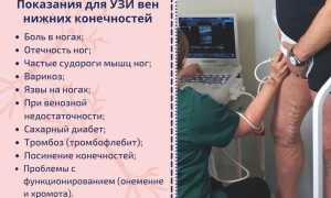 УЗИ сосудов ног. Что показывает, как делают