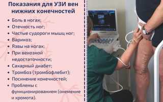 УЗИ сосудов ног. Что показывает, как делают