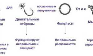 Спинально-мышечная атрофия у детей, взрослых. Что это такое, симптомы, лечение, клинические рекомендации