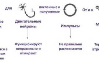 Спинально-мышечная атрофия у детей, взрослых. Что это такое, симптомы, лечение, клинические рекомендации