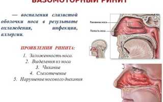 Називин (Nasivin) для детей. Инструкция по применению: спрей, капли. Цена, отзывы